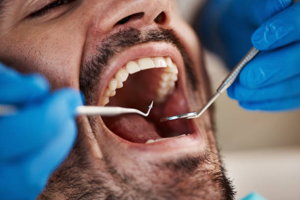 Best Emergency Dental Services for Seniors in Montgomery, AL