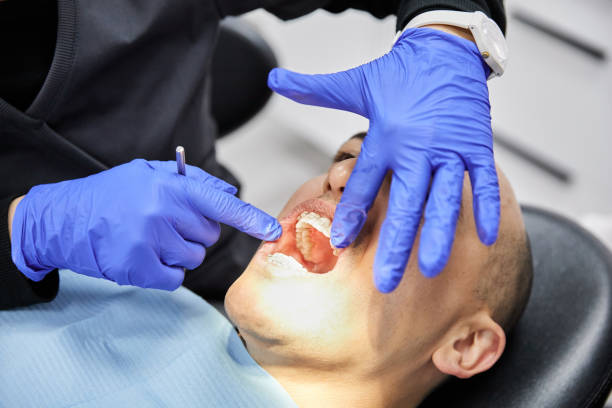 Best Emergency Dental Care for Abscessed Tooth in Montgomery, AL